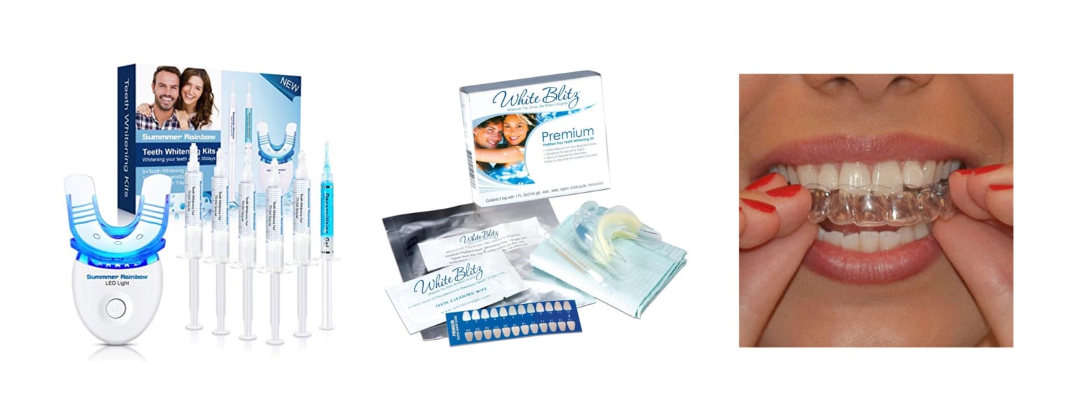 Teeth Whitening in Japan Honest Guide to a Glamorous Smile Japan 